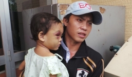 Cha ruột bé gái 4 tuổi bị hành hạ đến bệnh viện nhận con